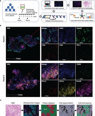 Spatial distribution of tumor-infiltrating T cells indicated immune response status under chemoradiotherapy plus PD-1 blockade in esophageal cancer